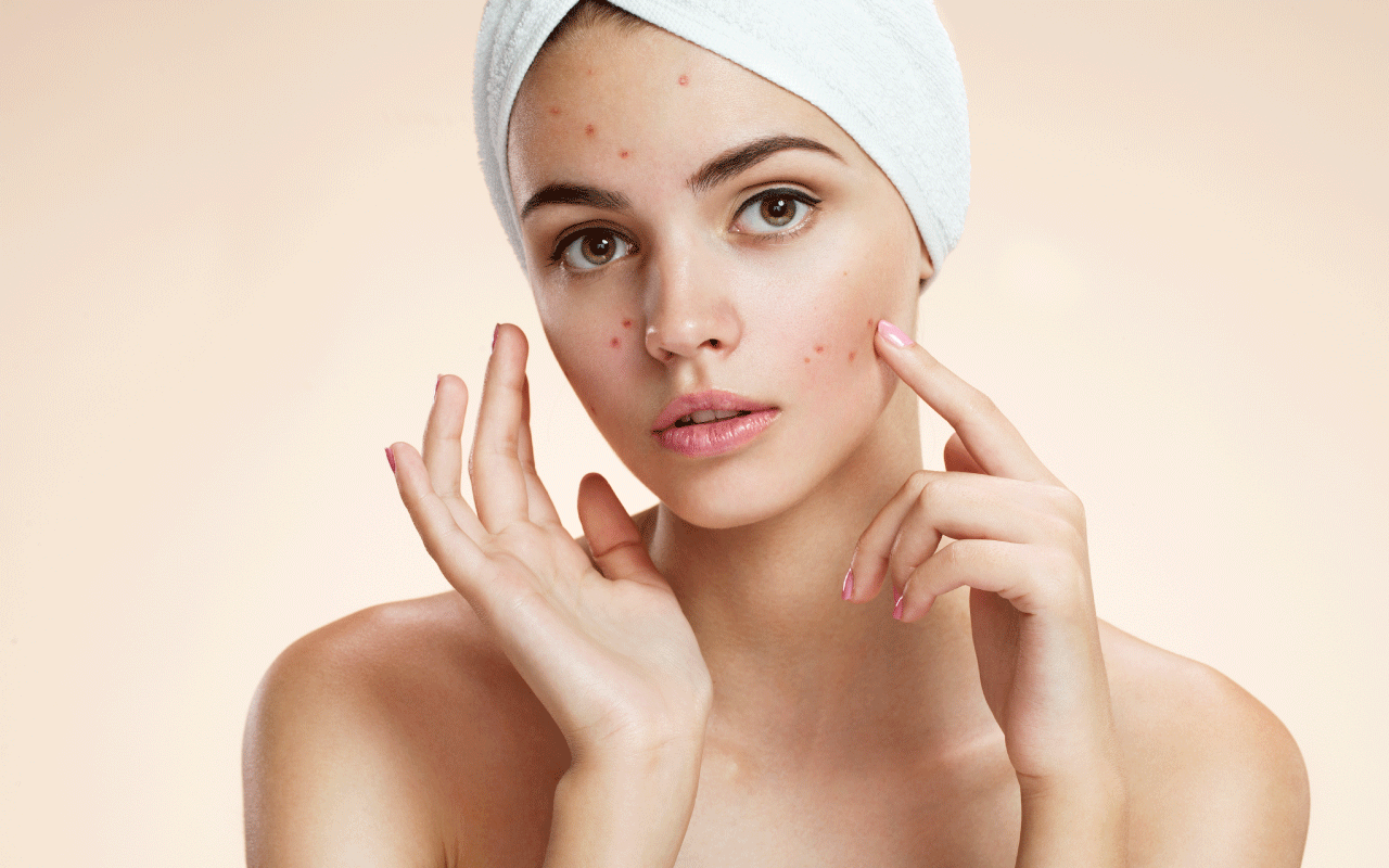 Cô dâu làm gì để có làn da đẹp trước ngày cưới 2